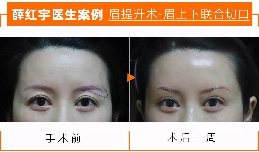 明星逃不过的年龄,眼睛衰老比较明显的明星