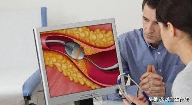 颈动脉有斑块就要吃他汀,颈动脉斑块究竟用不用吃他汀