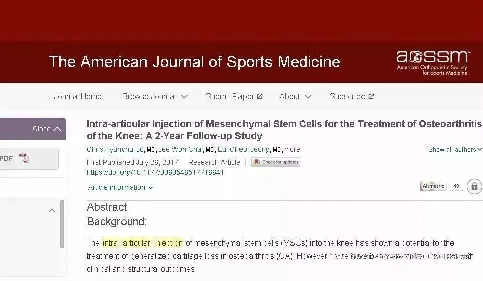 为什么干细胞成为治疗关节疼痛的最佳选择，来看看这些实例