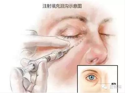 北大整形教授张宗学,张宗学博士微整形