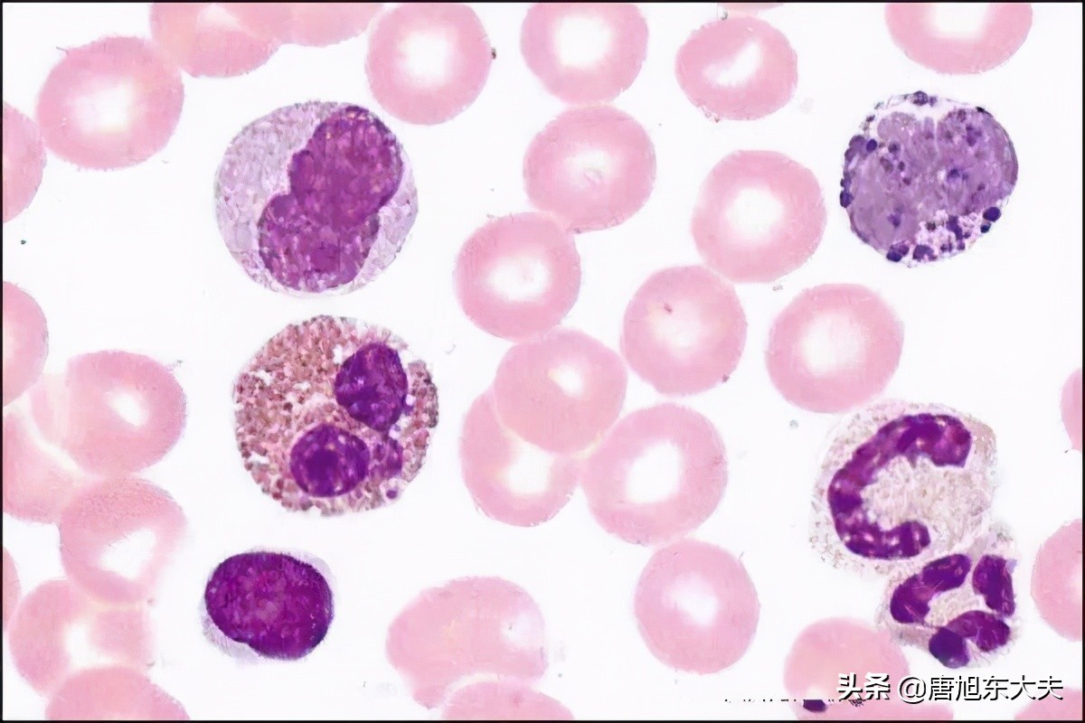 白细胞太低血常规有可能测不出吗,血常规查出白细胞低是怎么回事