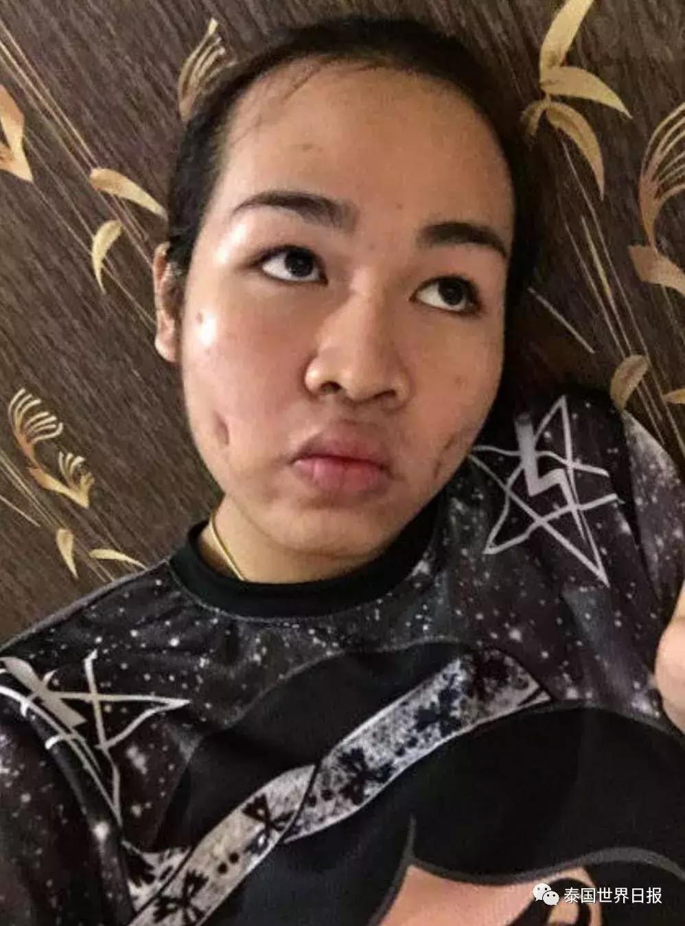 泰国网红Pond妹5年整容史：隆鼻、纹眉、凸魔唇