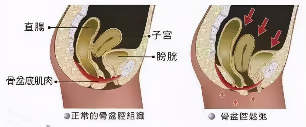 生孩子后容易衰老的特征,为何女性产后衰老那么快