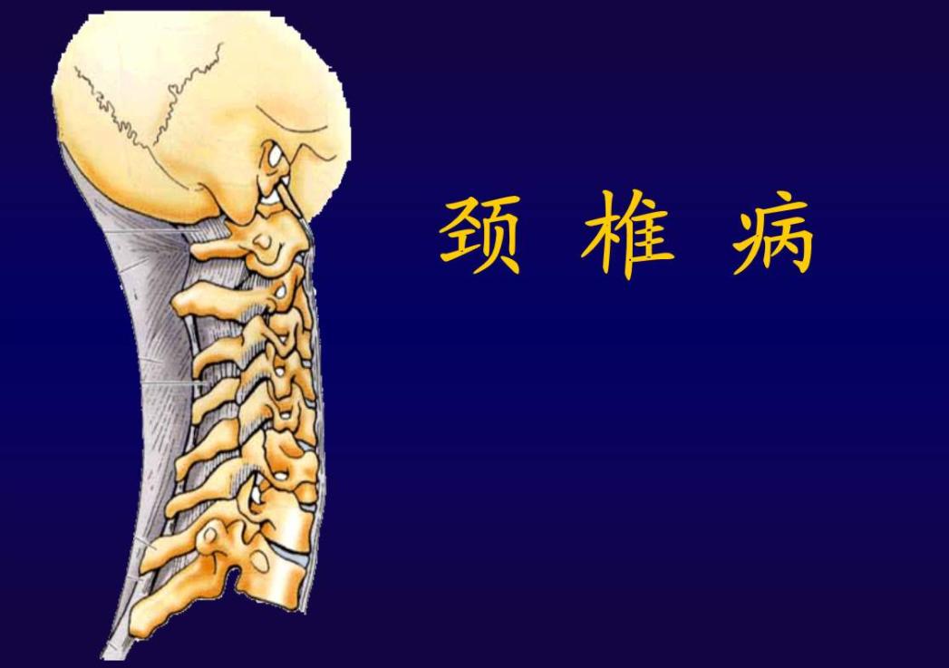 脖子后面的筋一按咔咔响怎么回事,颈椎病脖子里面咔咔响怎么回事