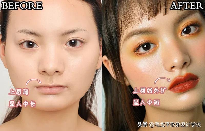 人中长有什么变短的小妙招吗,人中长怎么缩短人中