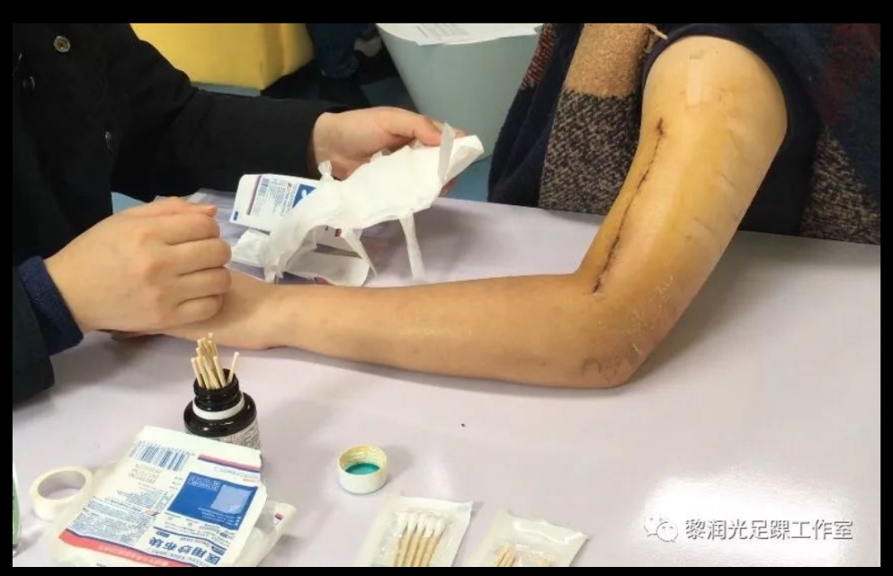 术后自己在家换药应该关注什么,医院手术后换药流程