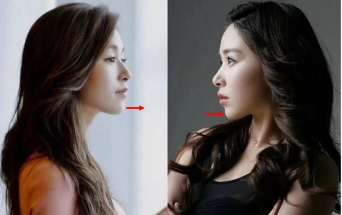 面部一枝花全靠鼻当家，论鼻子对颜值的重要性▼