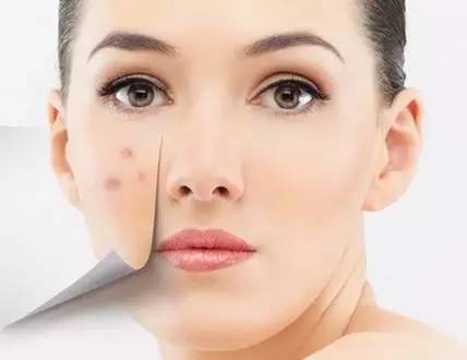 有痘印痘痘怎么护肤,有痘印痘痘怎么祛除学生