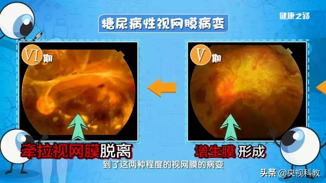 眼底照相全过程,拍一张眼睛的照片