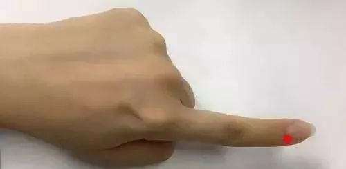 按手指哪个部位可治失眠,刮十指治便秘