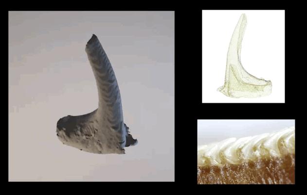 孩子膀胱容量130,儿童最大膀胱容量197正常吗