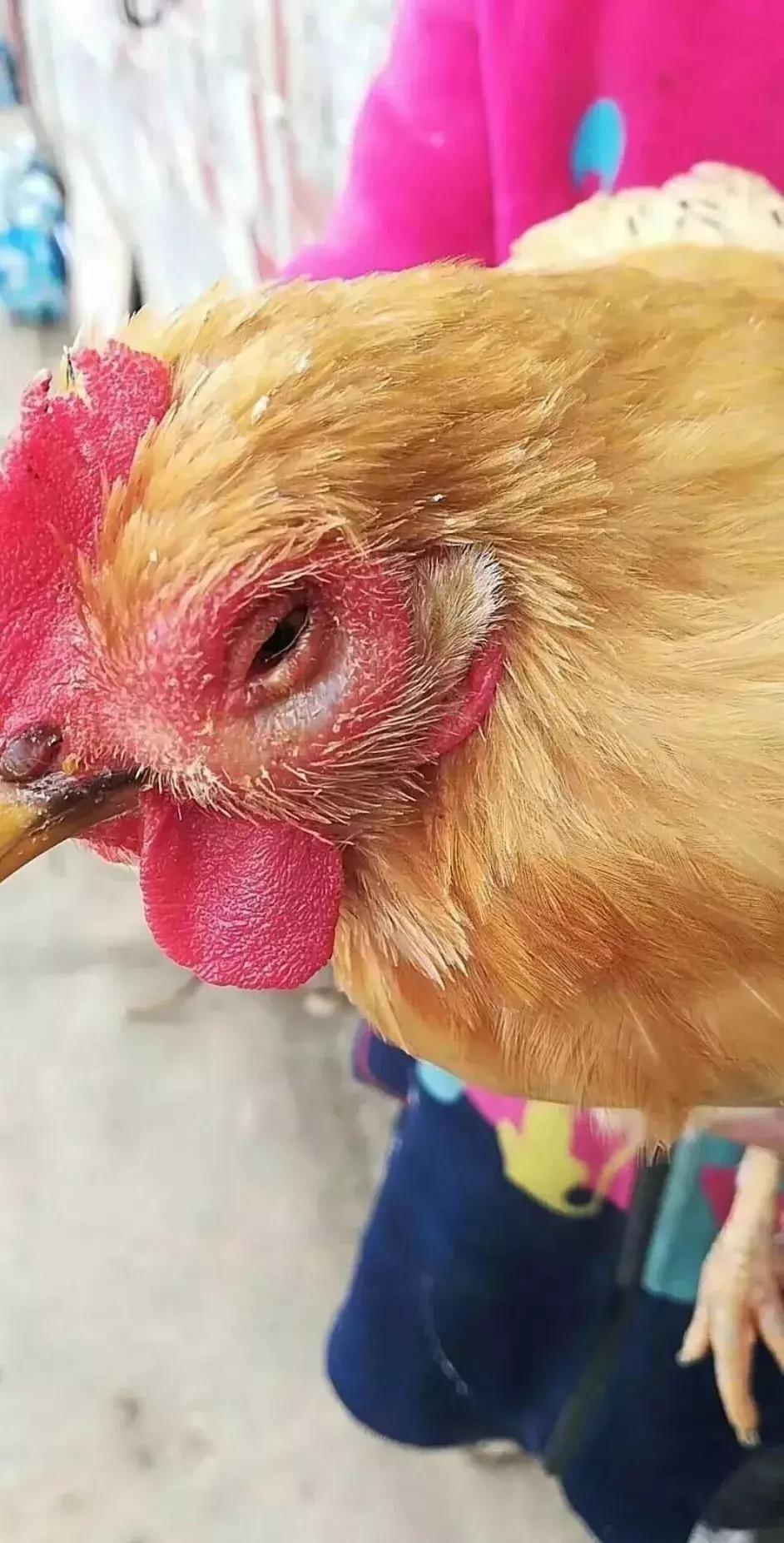 鸡肿眼是什么病用什么药治疗,鸡眼睛肿是什么情况怎么治疗