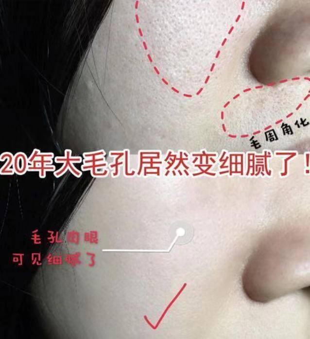 美容针变“毒针”，19岁女孩被毁容，医生：打针有风险跟风需谨慎