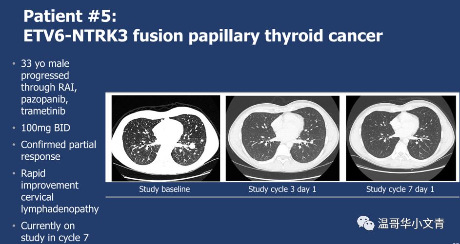治甲状腺的抗癌药有吗,120万一针抗癌药能治甲状腺癌吗