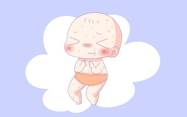 婴儿湿疹宝妈护理知识,湿疹护理婴儿视频