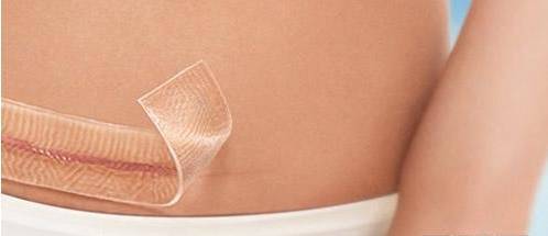 剖腹产一年半以后阴雨天刀口痒,剖腹产刀口6个月还红痒正常吗