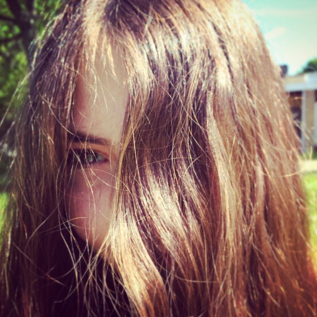 怎样拯救已经秃没了的发际线,防止发际线秃顶的方法