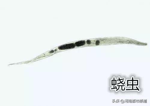 4岁女童屁屁痒，妈妈脱下裤子检查后吓坏了！一粒粒竟还会动