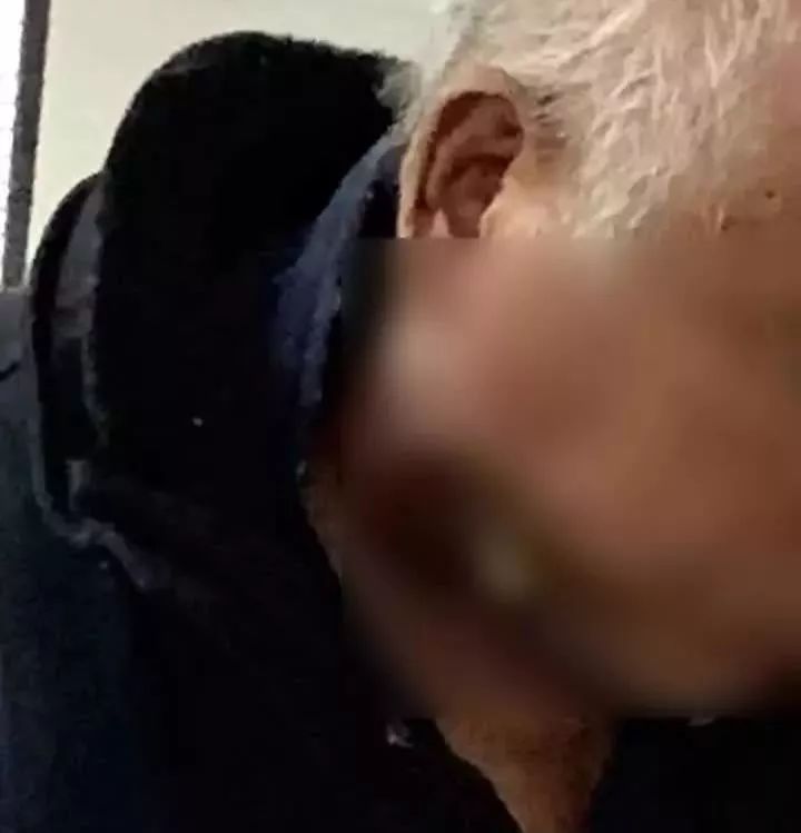 口腔溃疡穿孔医生说可能是瘤,口腔溃疡化脓穿孔