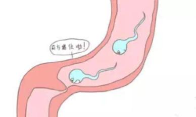 带环后还要采取其他避孕措施吗,带环后大出血怎么回事