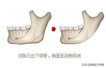 头大脸大的女生怎么办,头大的女生怎么显小