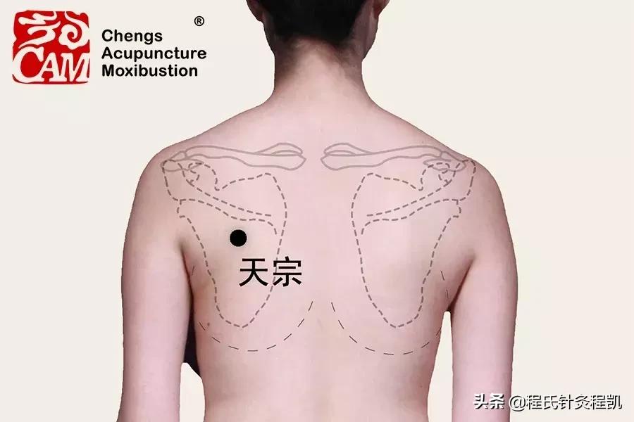 经期后一周乳腺增生疼痛,乳腺增生经期前疼痛是怎么回事