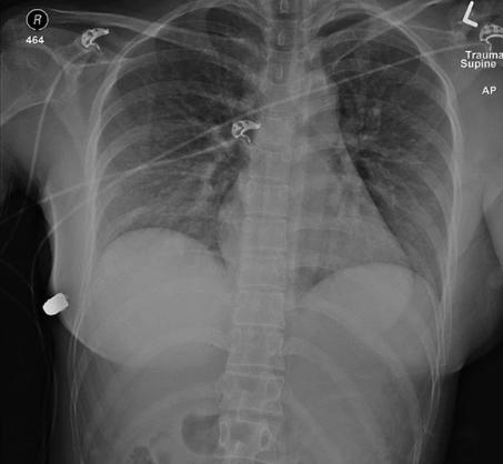 加拿大一名女子遭枪击,加拿大21岁女子被枪杀