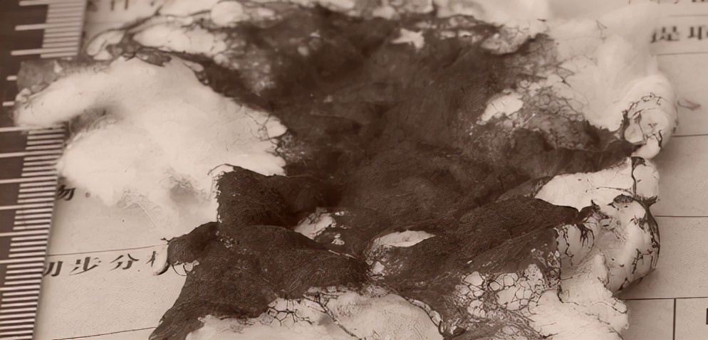 农家少女被杀案例,独居老妇被杀真实案例