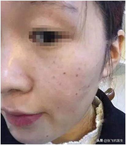 4种含叶黄素的食物是眼睛的最爱,四种易长斑的食物