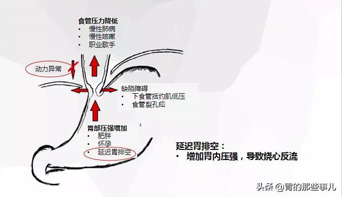 每次饭后胃胀怎么办,每次饭后胀气
