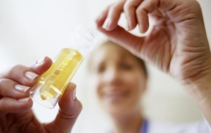 尿痛要留神这8种病尿液里暗藏的那些健康密码，必知