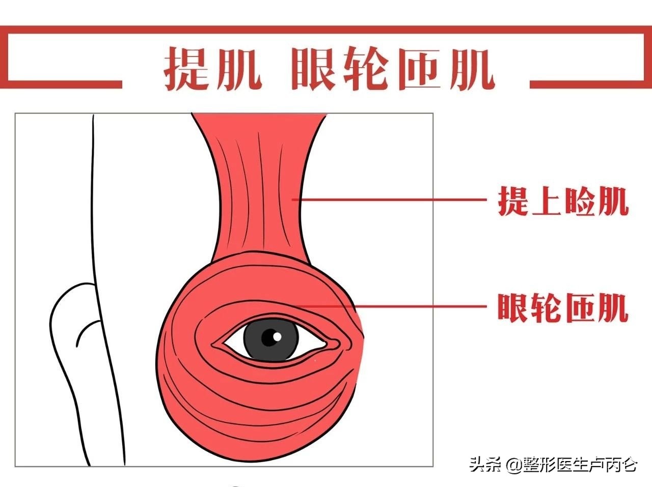 外切眼袋有哪些并发症,眼袋手术有可能出现哪些并发症