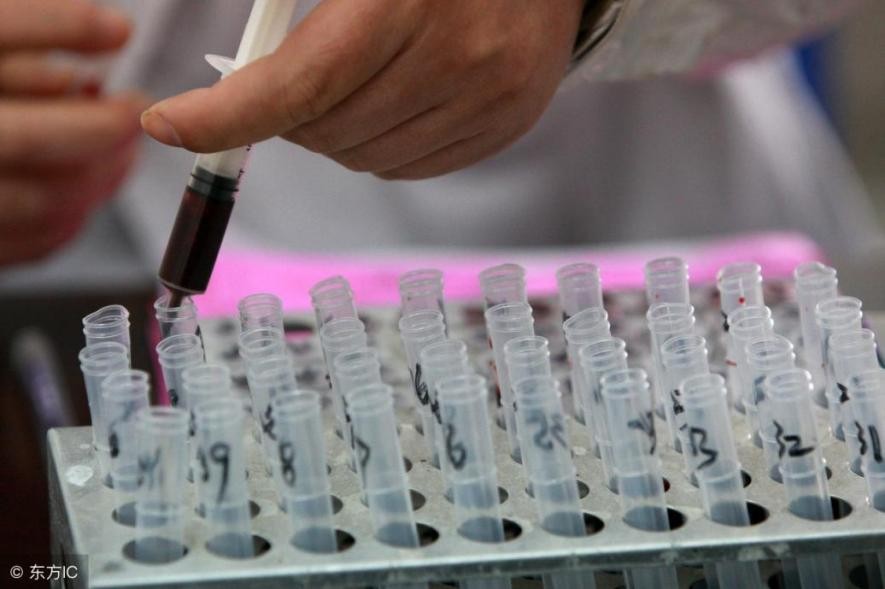 婚检要等结果出来才能领结婚证吗,领结婚证要提前去做婚检吗