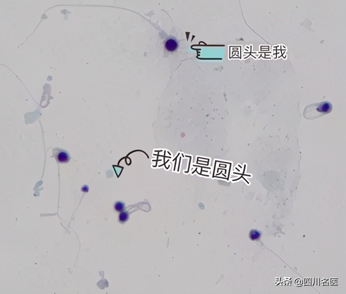精子是如何产生的百科,精子是不是每天都能生成