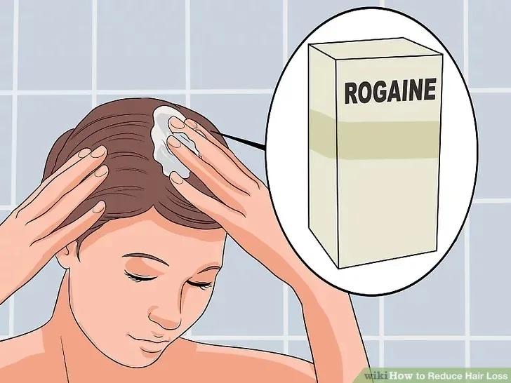 减少脱发的洗发水,脱发毛囊减少