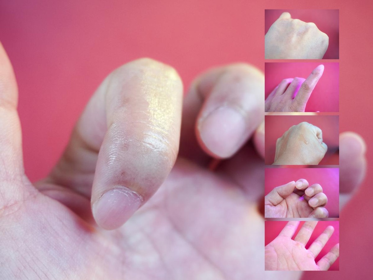 比较好用的液体创可贴,止血创可贴哪种好