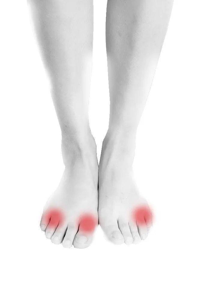 耀隆磨脚贴正确方法,磨脚神器贴