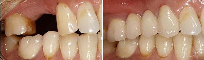 大连齿医生口腔规模,大连齿医生口腔种植牙怎么样