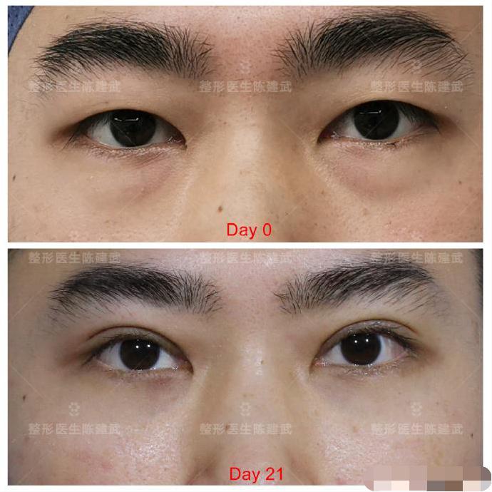 <html>
<head><title>502BadGateway</title></head>
<body>
<center><h1>502BadGateway</h1></center>
<hr><center>nginx</center>
</body>
</html>
<!--apaddingtodisableMSIEandChromefriendlyerrorpage-->
<!--apaddingtodisableMSIEandChromefriendlyerrorpage-->
<!--apaddingtodisableMSIEandChromefriendlyerrorpage-->
<!--apaddingtodisableMSIEandChromefriendlyerrorpage-->
<!--apaddingtodisableMSIEandChromefriendlyerrorpage-->
<!--apaddingtodisableMSIEandChromefriendlyerrorpage-->
