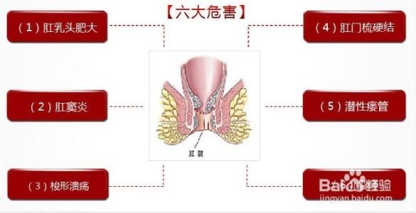 宝宝肛裂害怕排便,宝宝排便轻微肛裂怎么办