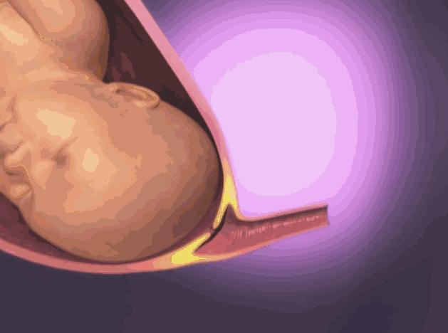 顺产生孩子剖腹产的真实流程,顺产剖腹产生孩子的真实流程