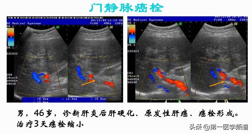 「医影传声」上海交通大学医学院附属瑞金医院卢湾分院放射科主任