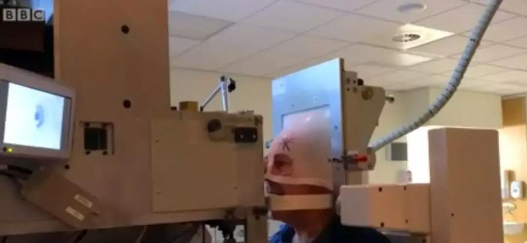 成年人眼癌的最新治疗方法,眼睛长肿瘤怎么治疗