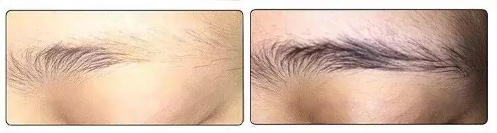 吉克隽逸睫毛增长液,吉克隽逸怎么变好看