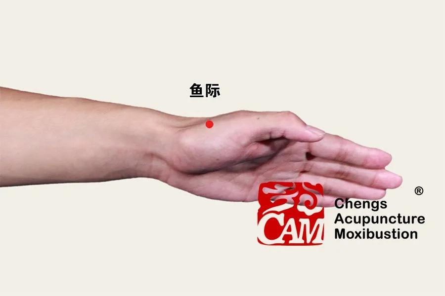 程凯针灸治疗糖尿病,程凯糖尿病讲座视频
