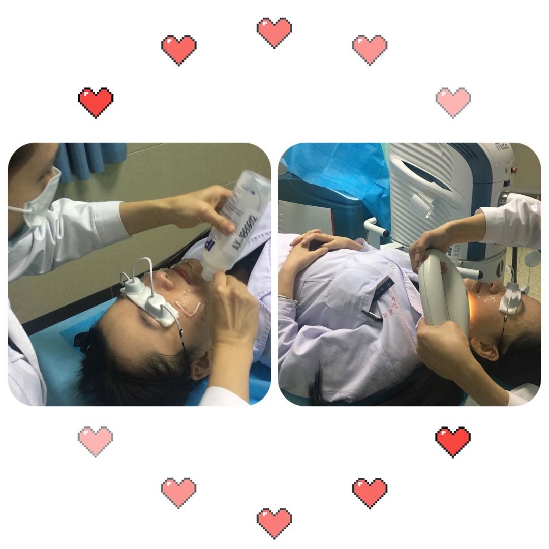 济南光子嫩肤全套体验,男士光子嫩肤体验