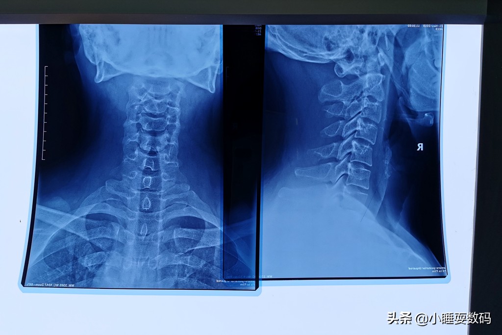 颈椎枕头可调节软硬高低护颈枕,如何正确选择枕头才能预防颈椎病