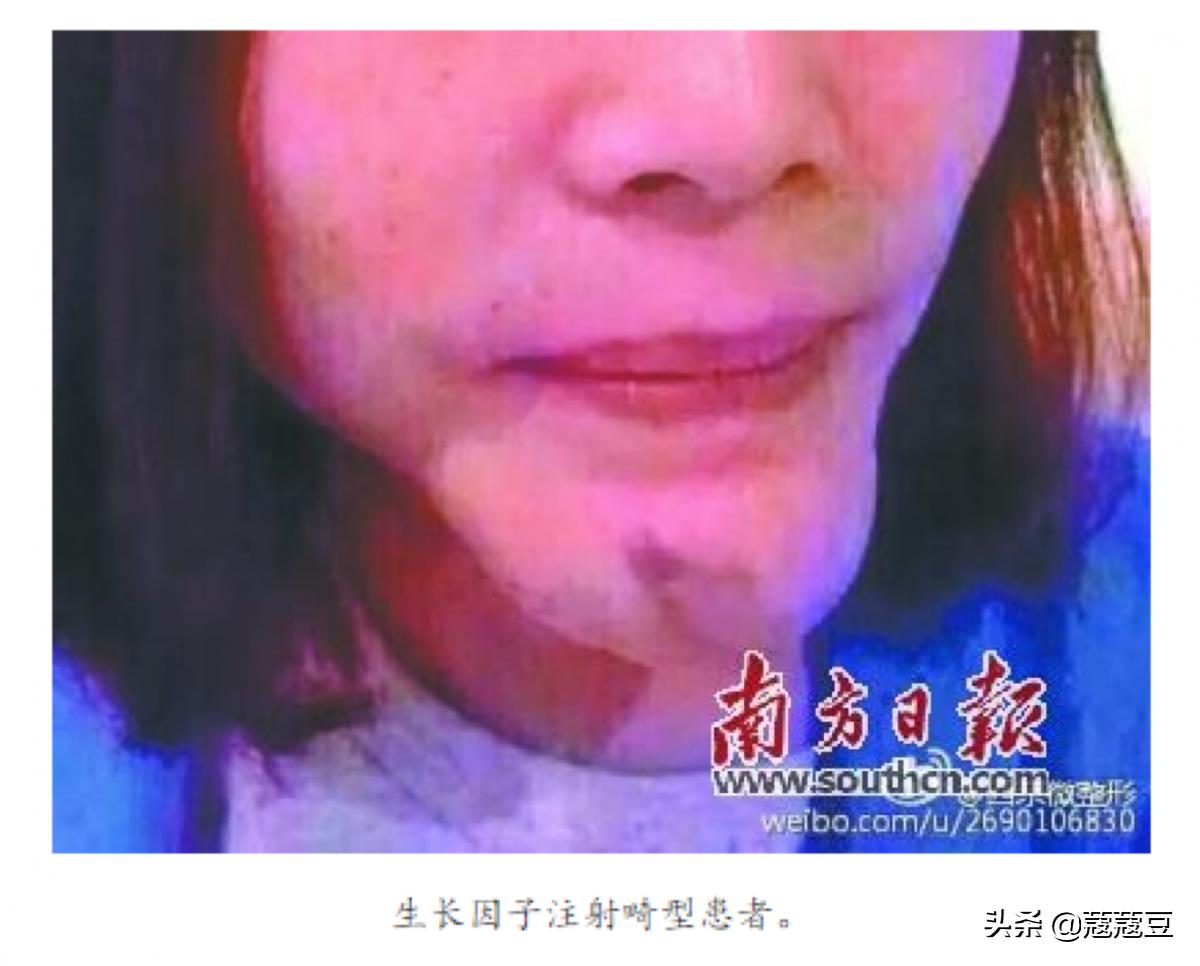 egf在护肤品中的作用与功效,egf加入护肤品有害处吗