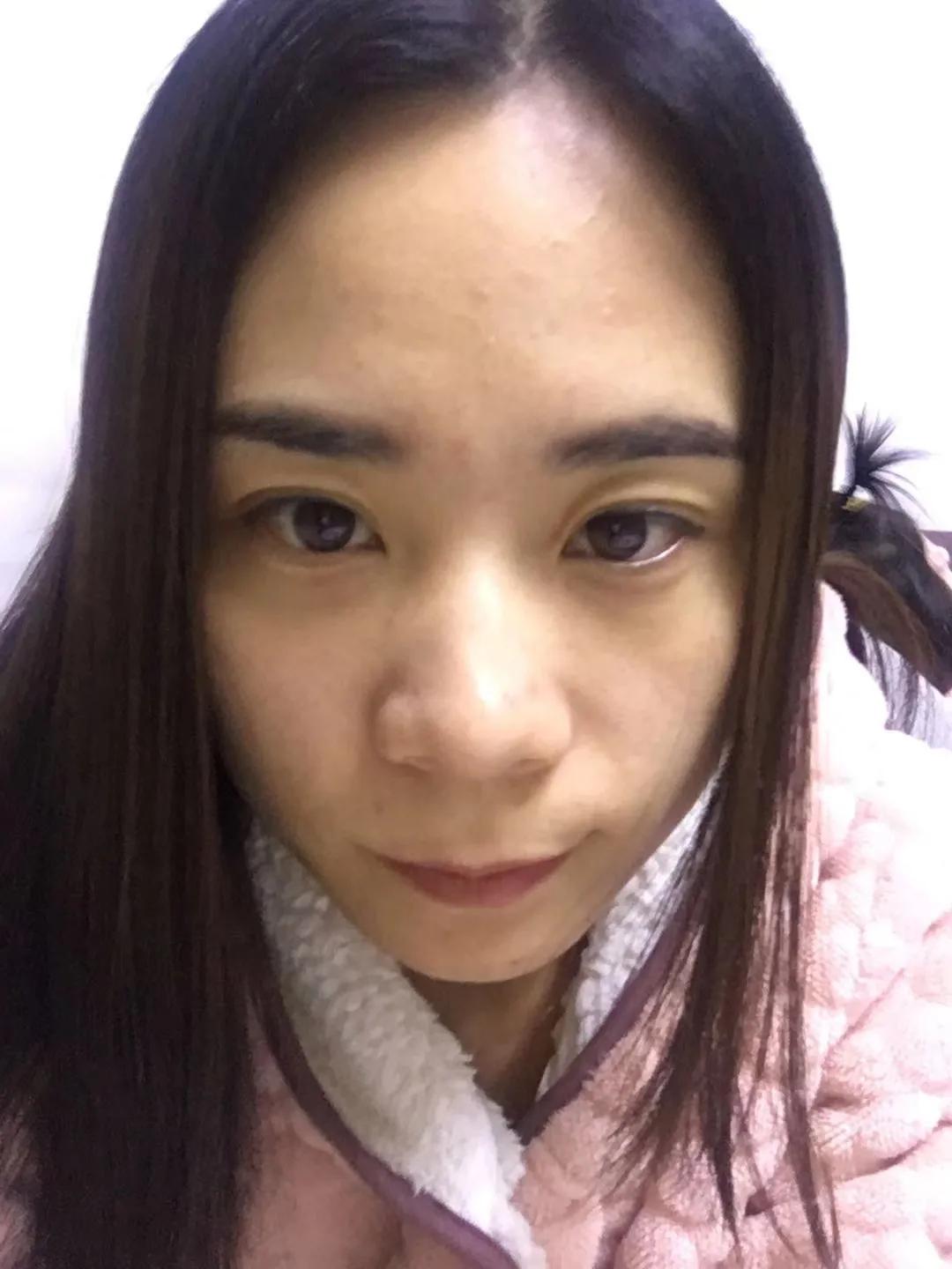 30多岁女人皮肤发黄怎么办,40岁的女人皮肤发黄暗沉怎么调理