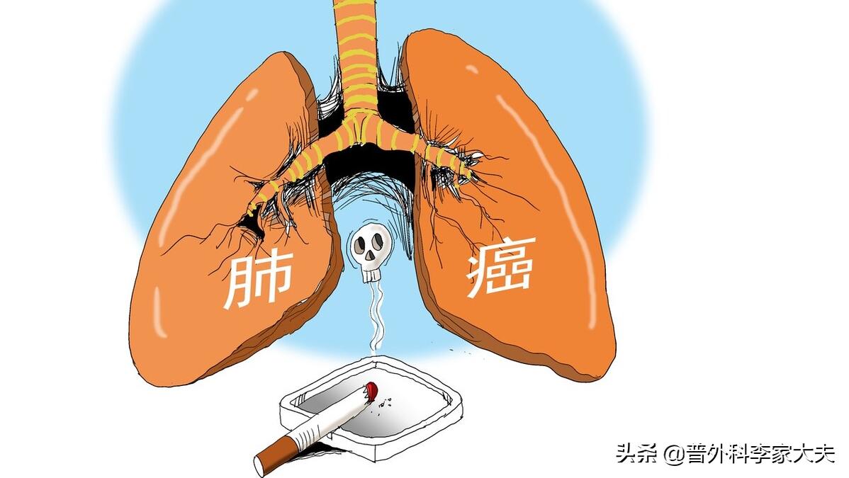 肺腺癌出现声音嘶哑能治好吗？